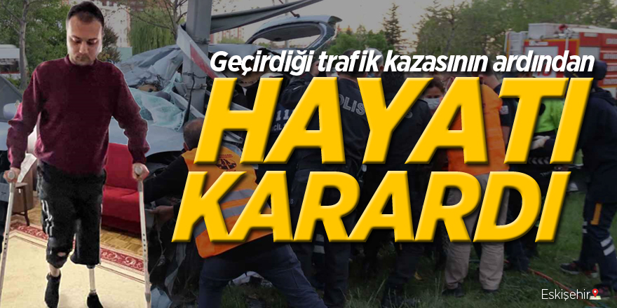 Geçirdiği trafik kazasının ardından hayatı karardı